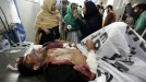 Ataque talibán en Pakistán. Foto: EFE.