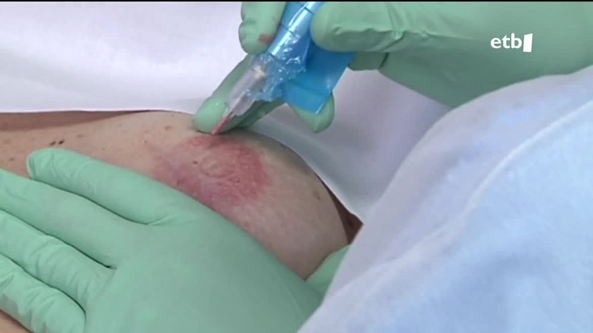 Micropigmentación en el pecho. Imagen extraída de un vídeo de EiTB MEDIA.